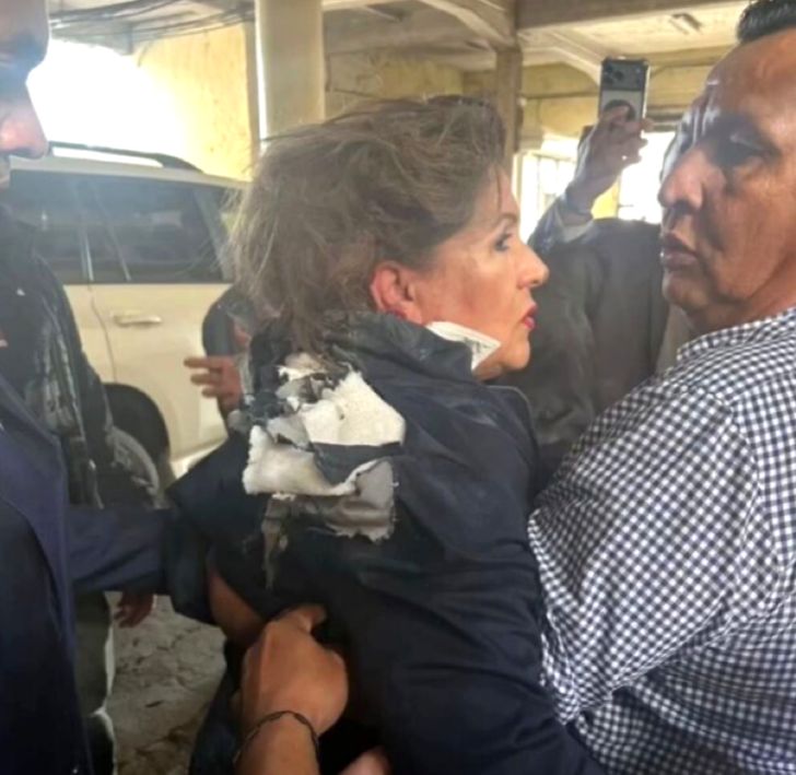 Deputada hondurenha é ferida por explosivo durante protesto em frente ao Congresso