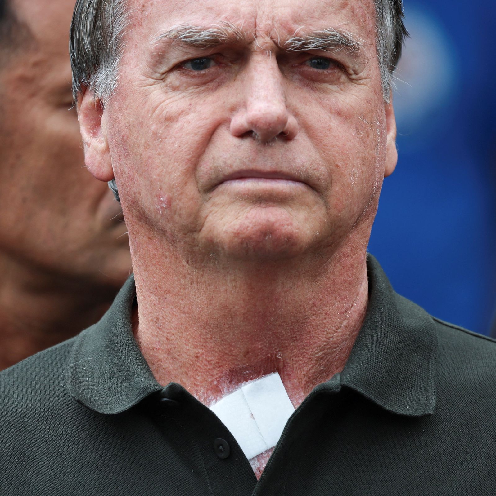 Laudo da PF aponta necessidade de cuidados médicos para Bolsonaro, mas descarta internação hospitalar